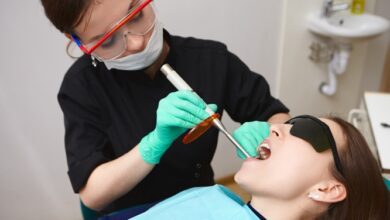 Best Veneers in Brisbane