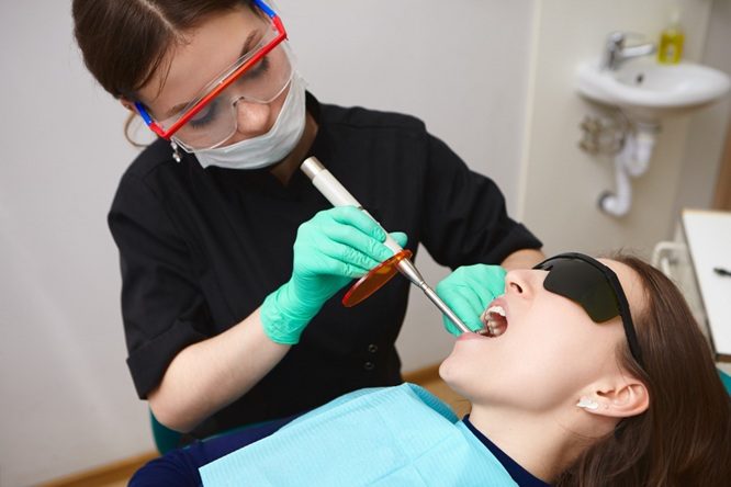 Best Veneers in Brisbane