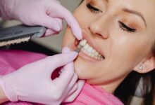 porcelain veneers brisbane